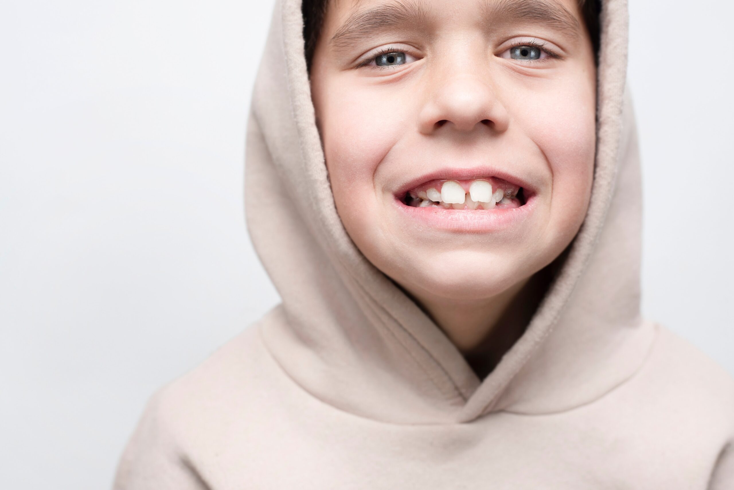 Boy with crooked teeth