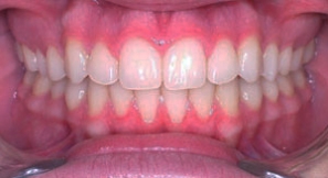 after image