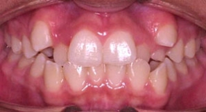 Before Image