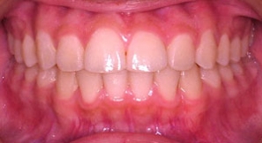 after image